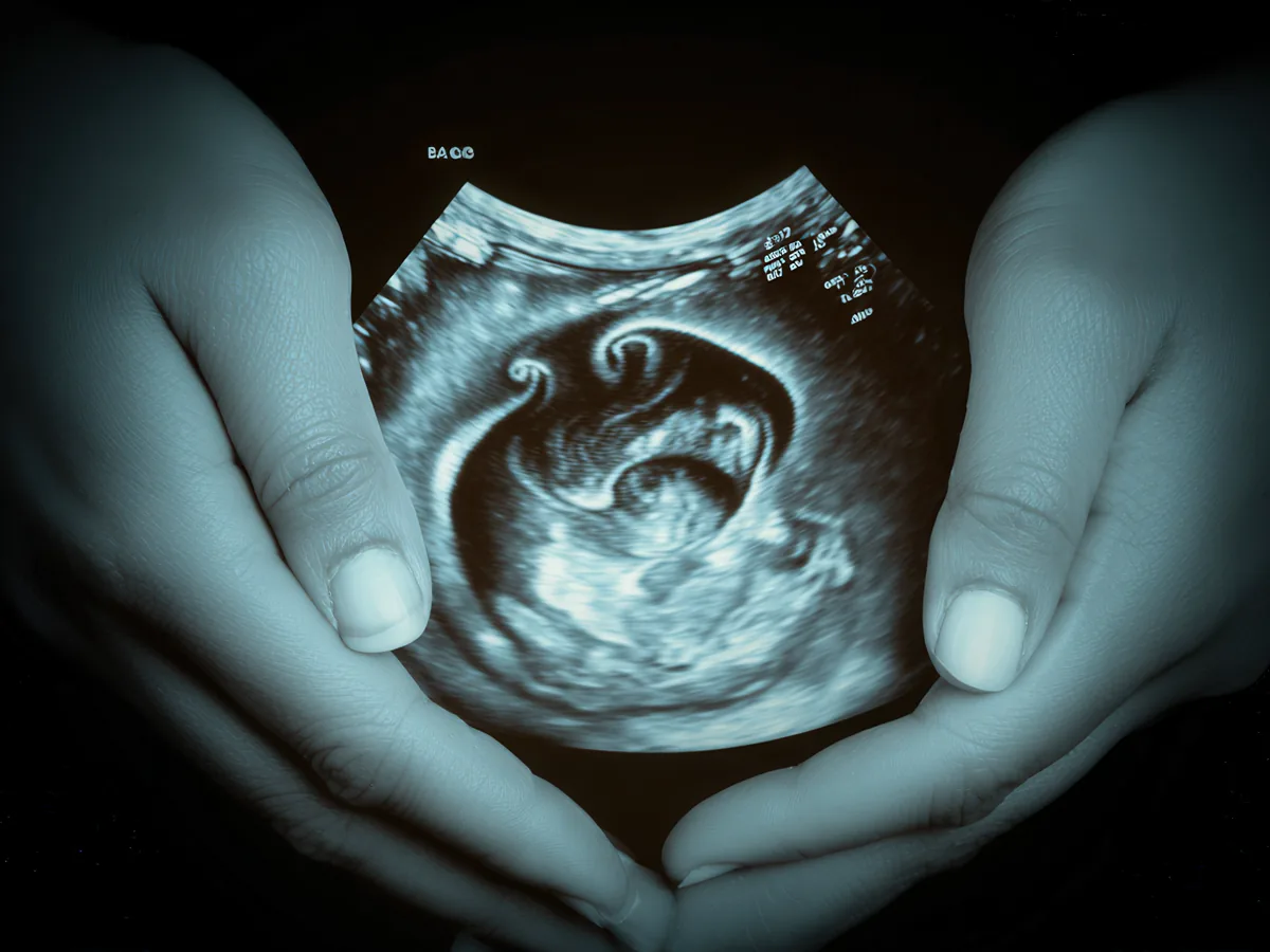 Gynae & Obstetrics